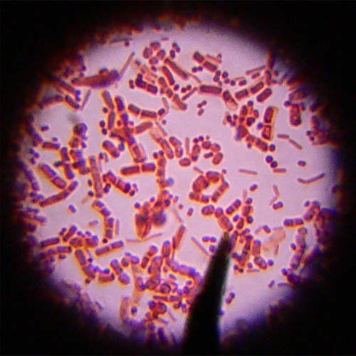 antibiotic-resistant-bacteria